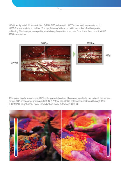 EASEMED EM4K 4K UHD Endoscopy & Laparoscopy Camera System | 3840×2160 60FPS Medical Camera | CMOS Surgical Endoscopy Imaging System with Camera Head